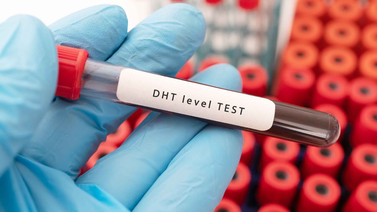 Blocks Dihydrotestosterone (DHT) Effects-