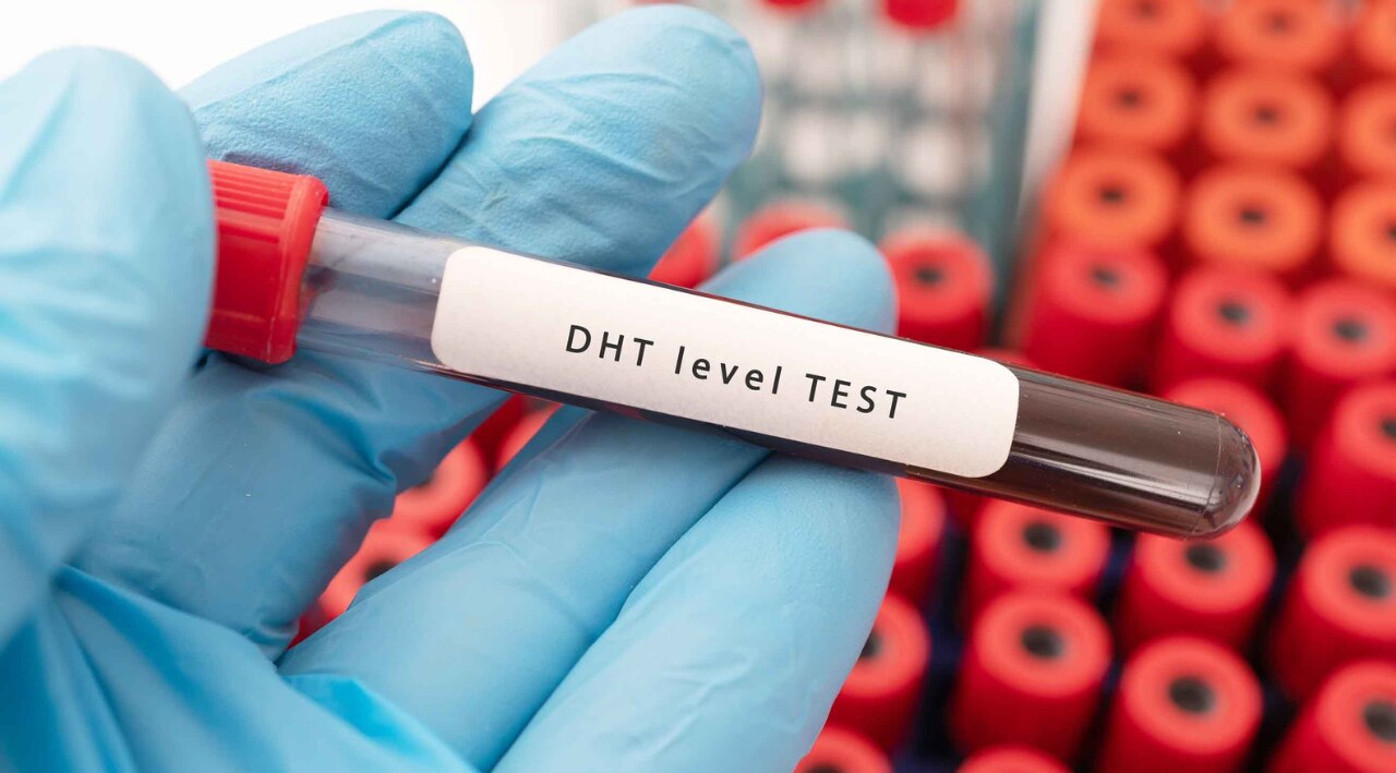 Blocks Dihydrotestosterone (DHT) Effects-