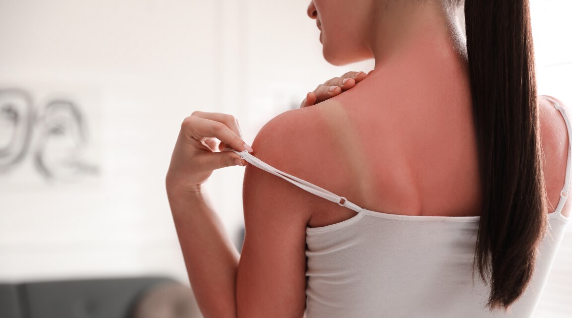 Complete Guide to Body Tan Removal for Even-Toned Skin