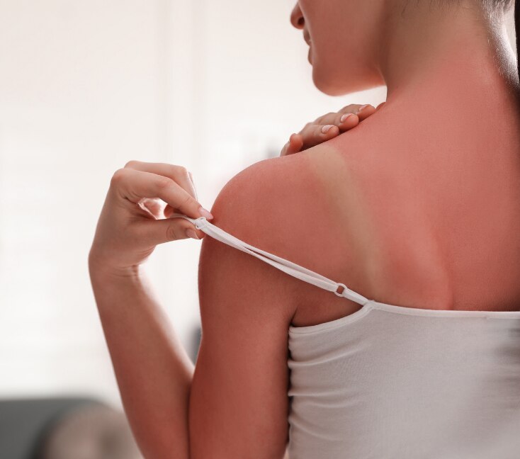 Image of How to Remove Tan: Complete Body Tan Removal Guide for Brighter, Even-Toned Skin