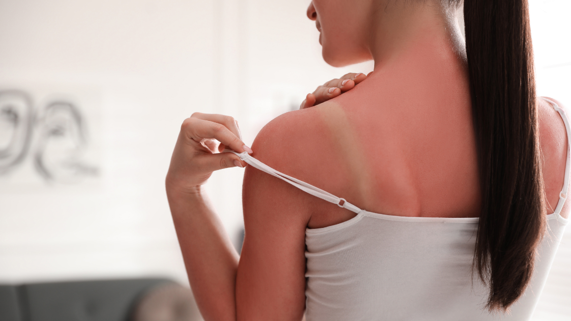 Complete Guide to Body Tan Removal for Even-Toned Skin
