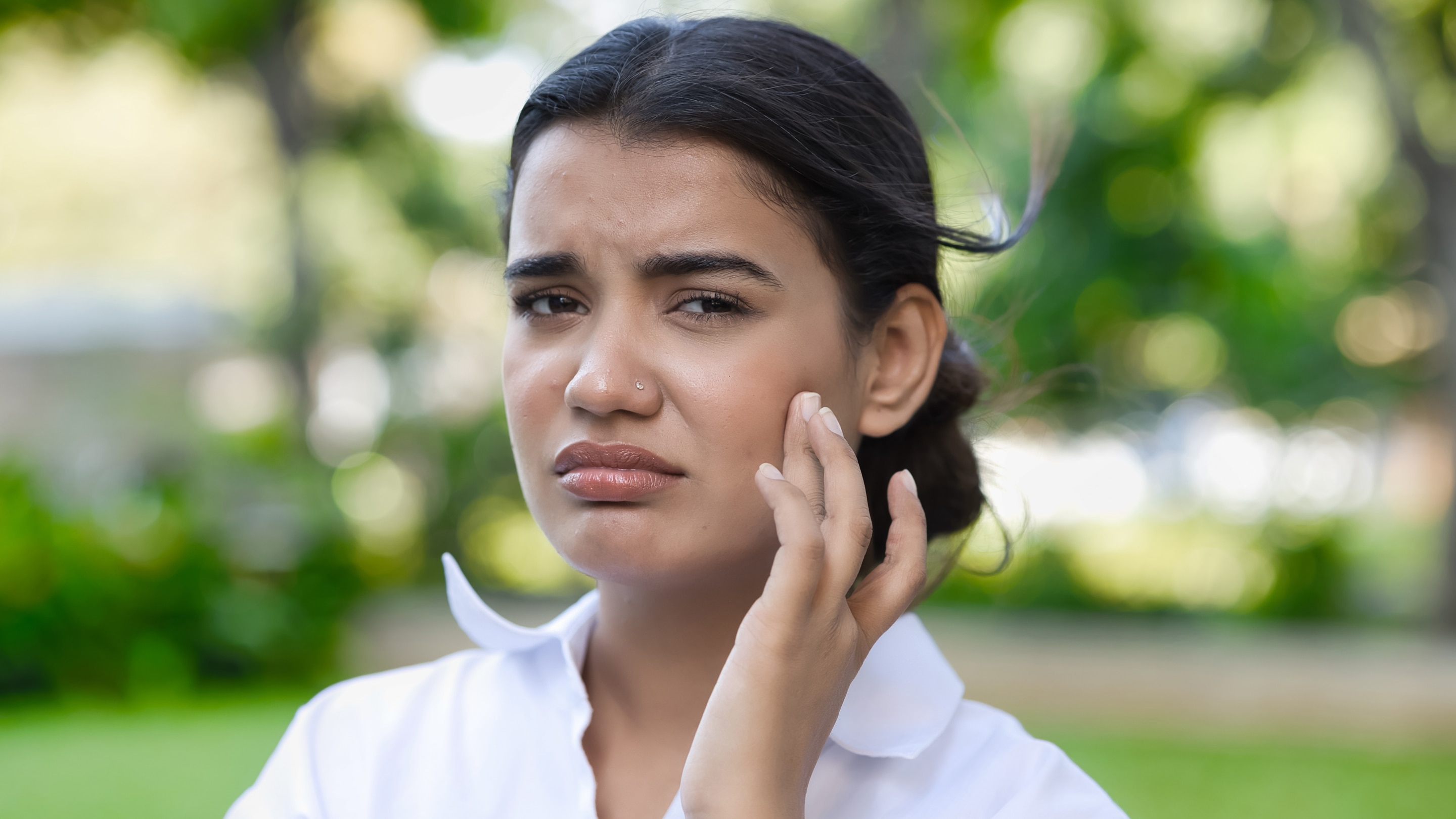 Symptoms of PCOS Acne