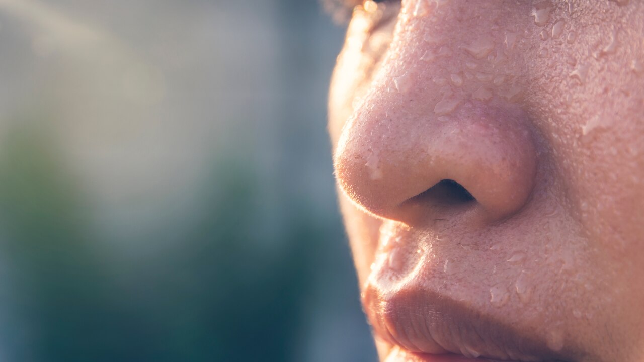 Clogged pores: