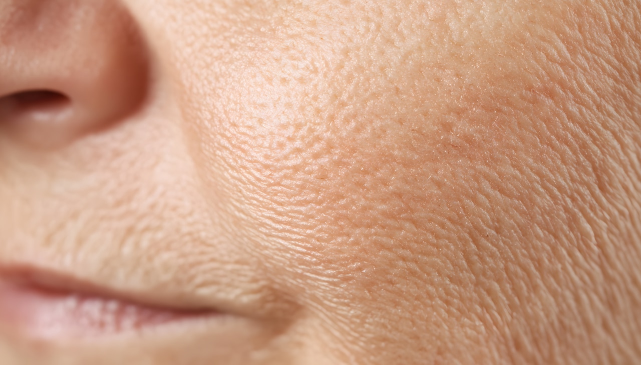 What Are Clogged Pores?