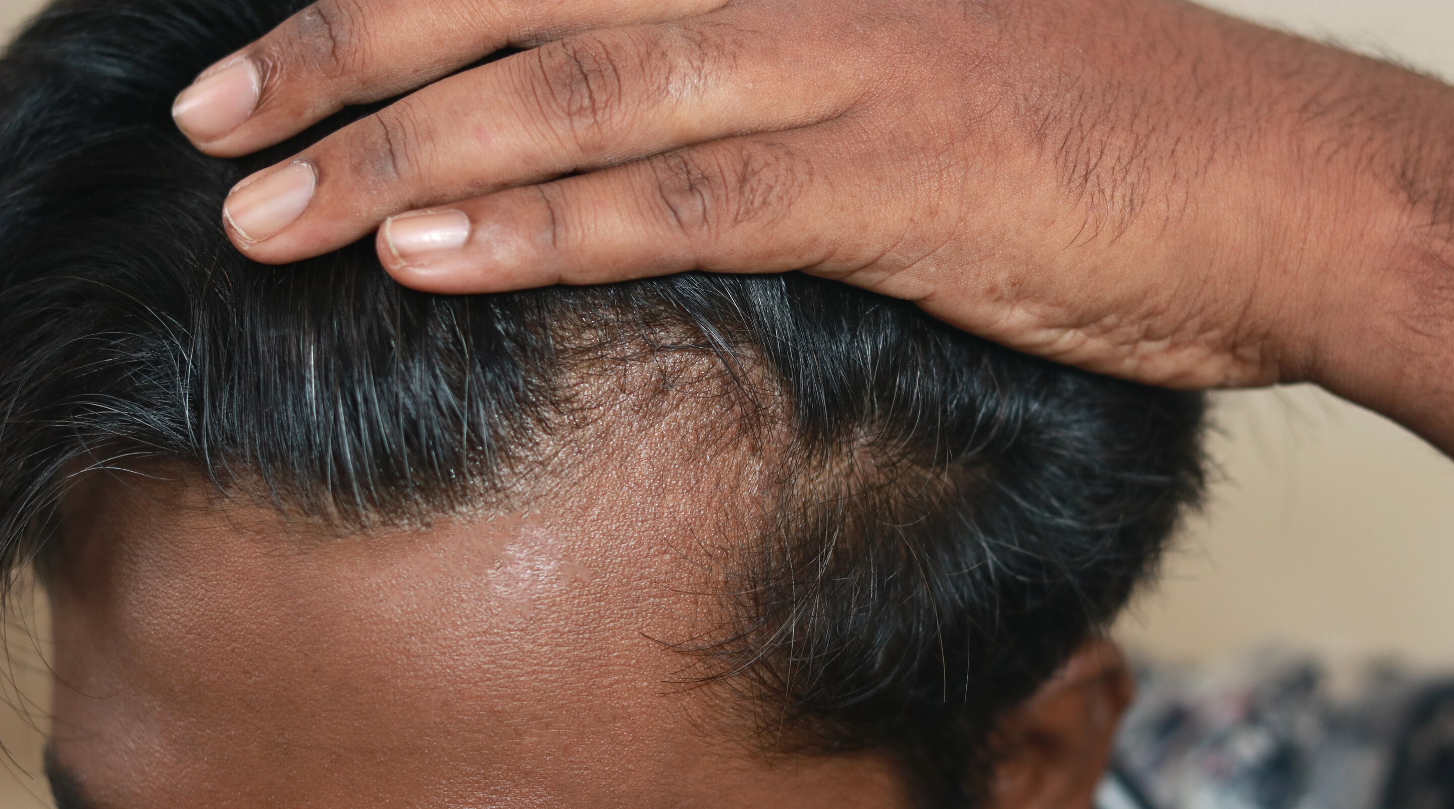 Classy Haircuts for Men with Receding Hairline