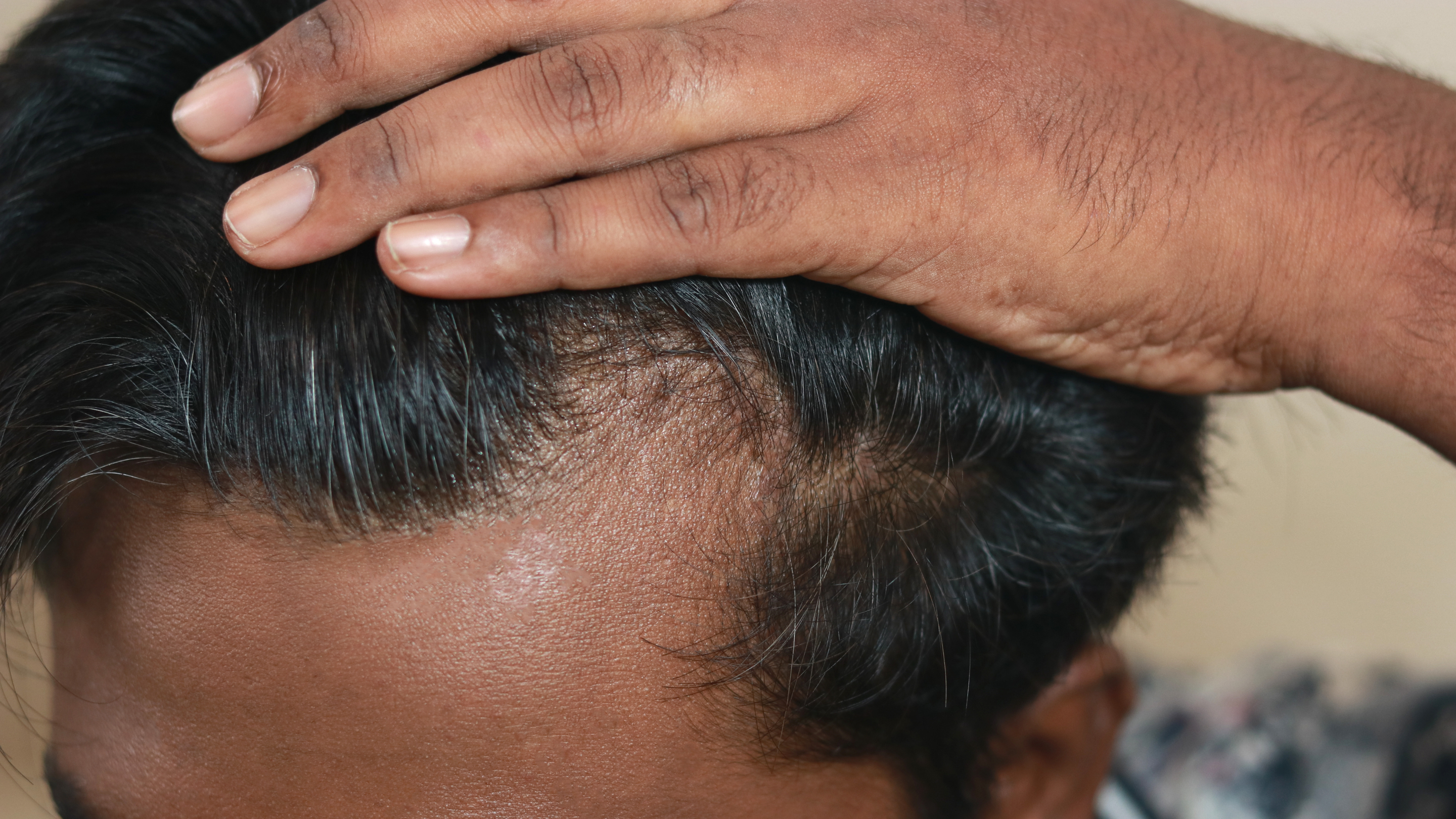 Classy Haircuts for Men with Receding Hairline