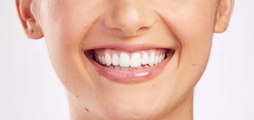 memutihkan gigi dengan dalam 2 hari