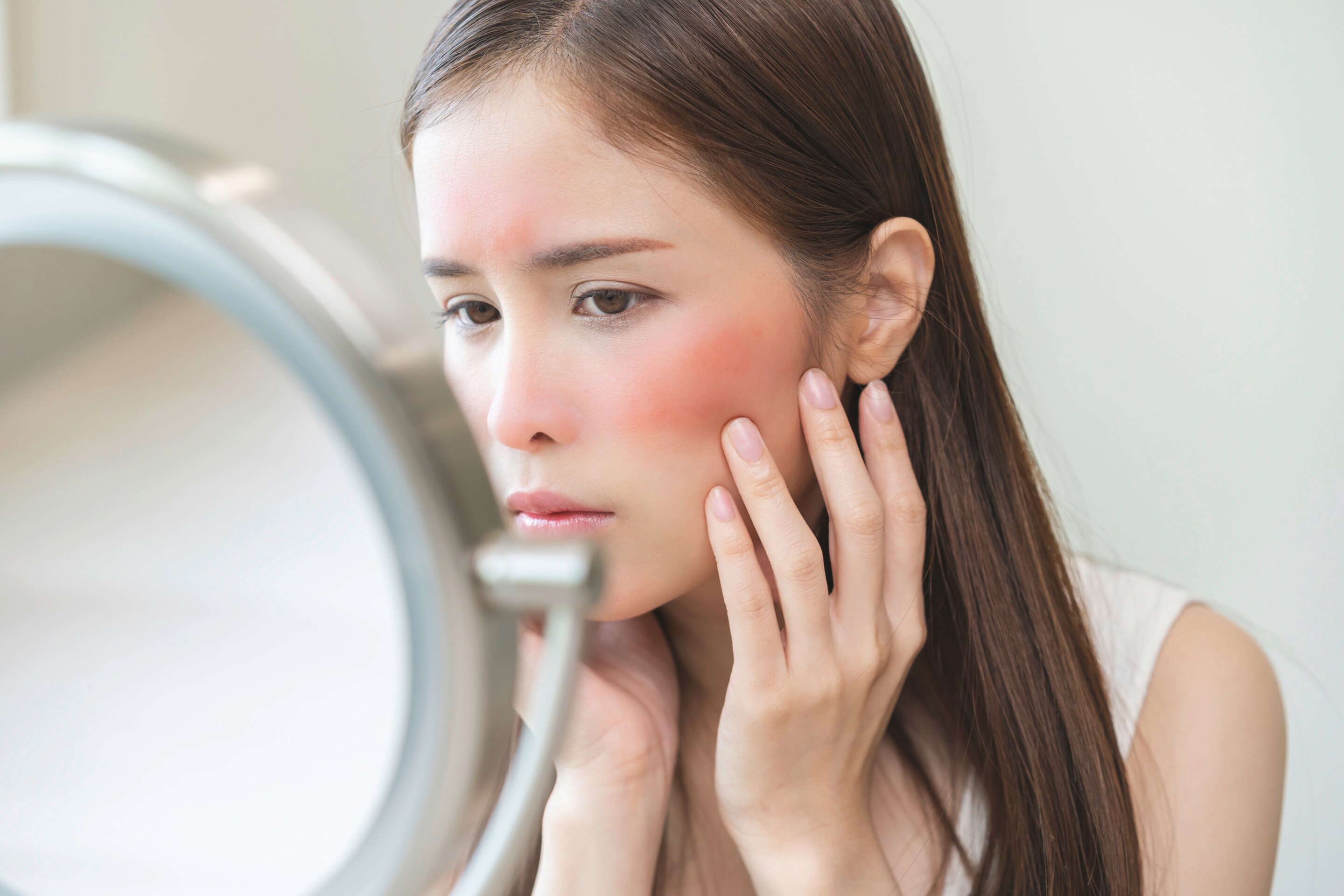 ผู้หญิงเอเชีย ส่องกระจก สีหน้ากังวล มือแตะแก้มที่มีรอยผื่นแดง