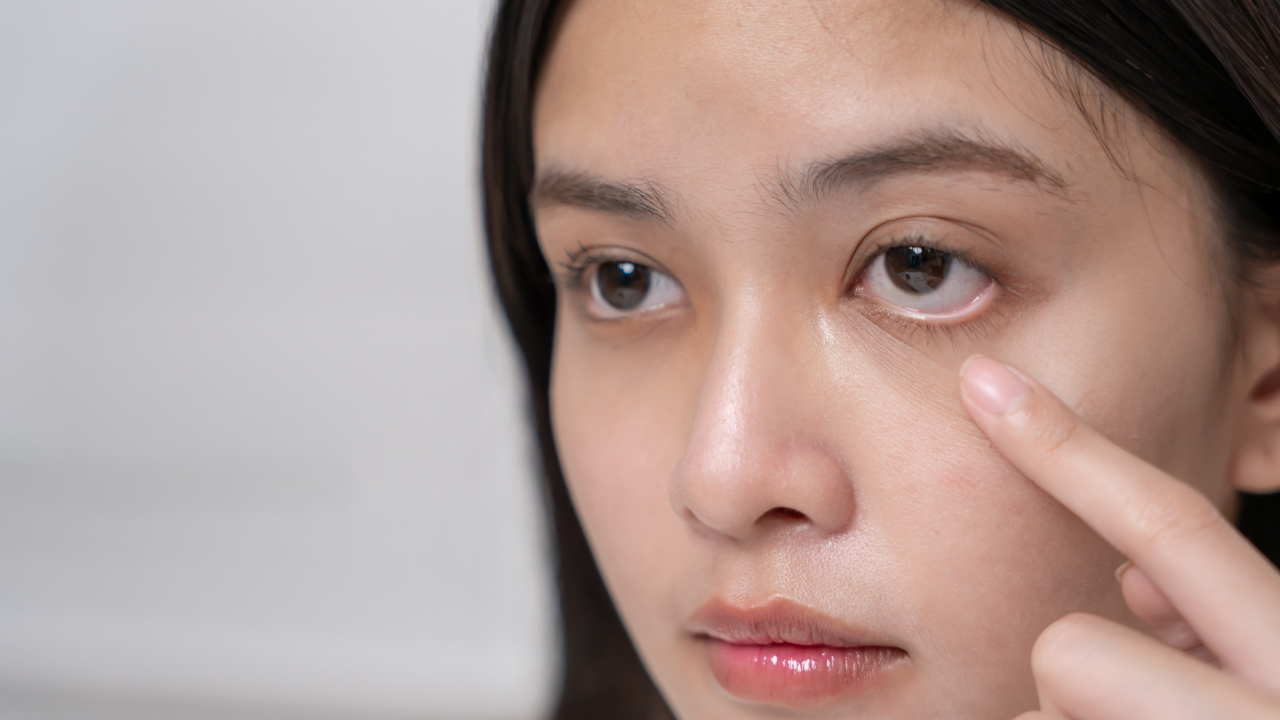 How Under Eye Serums Help Reduce Dark Circles