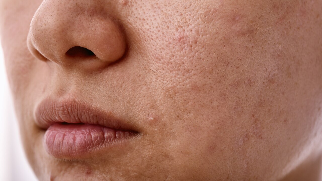 Possible Side Effects & Safety Precautions