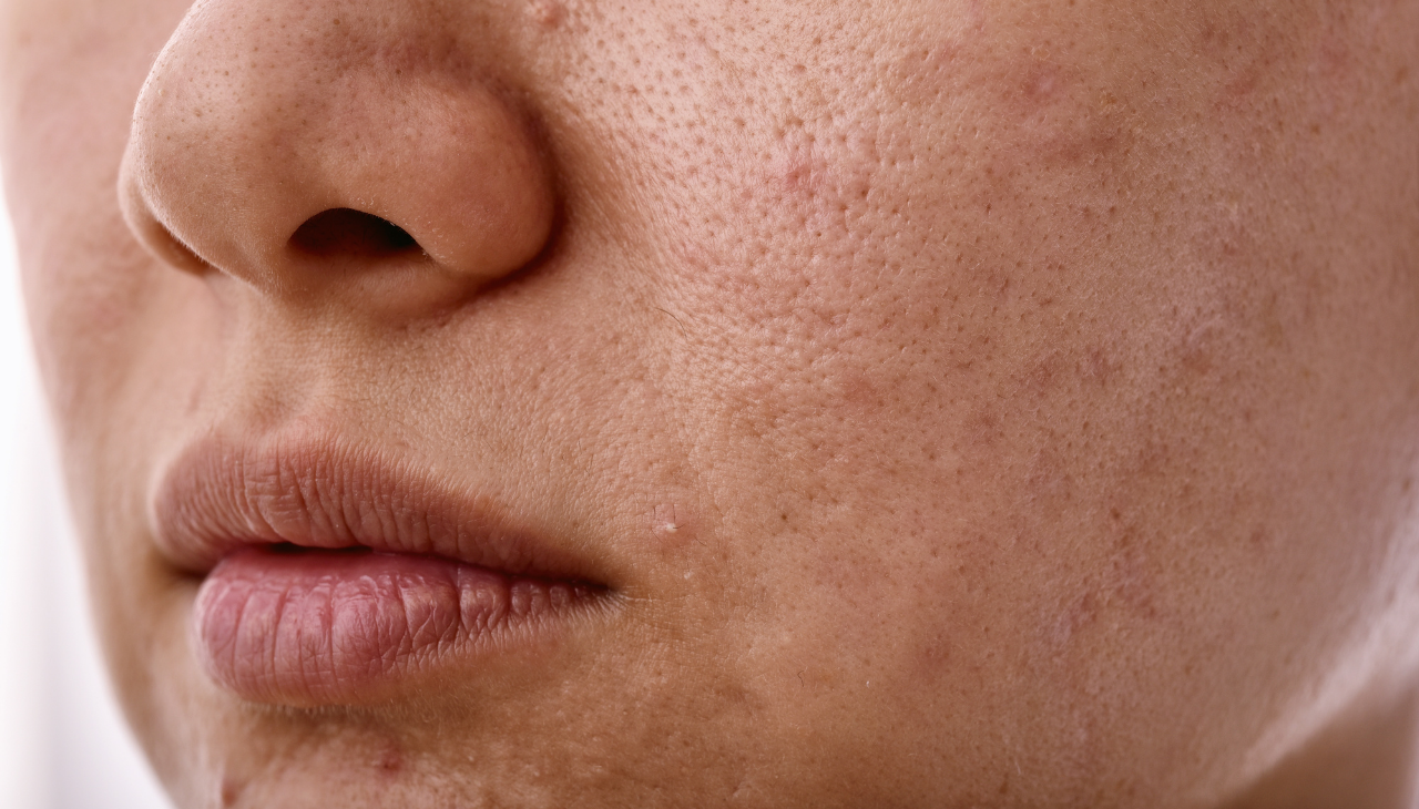 Possible Side Effects & Safety Precautions