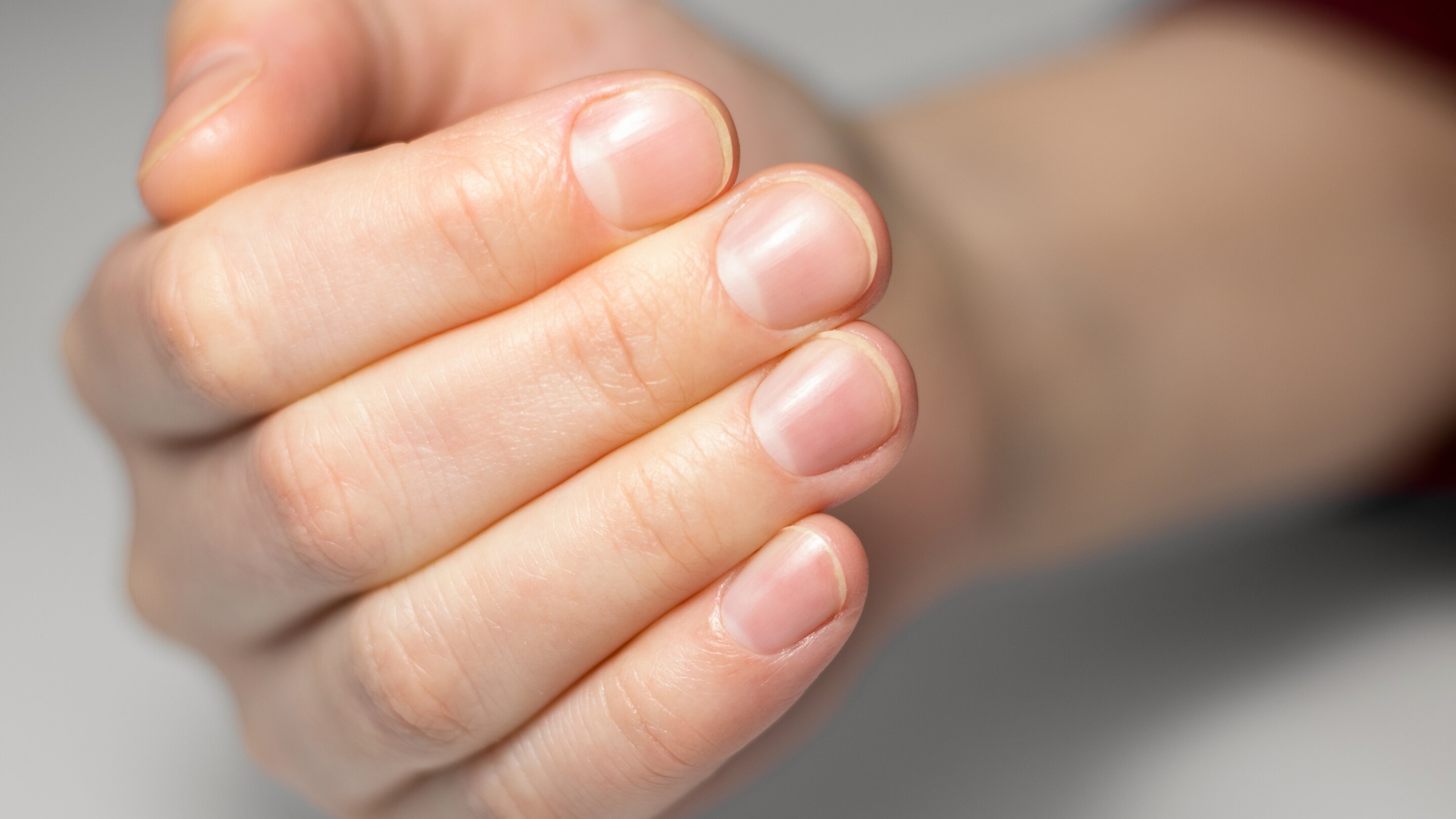 Step 1: Assess Your Natural Nail Health