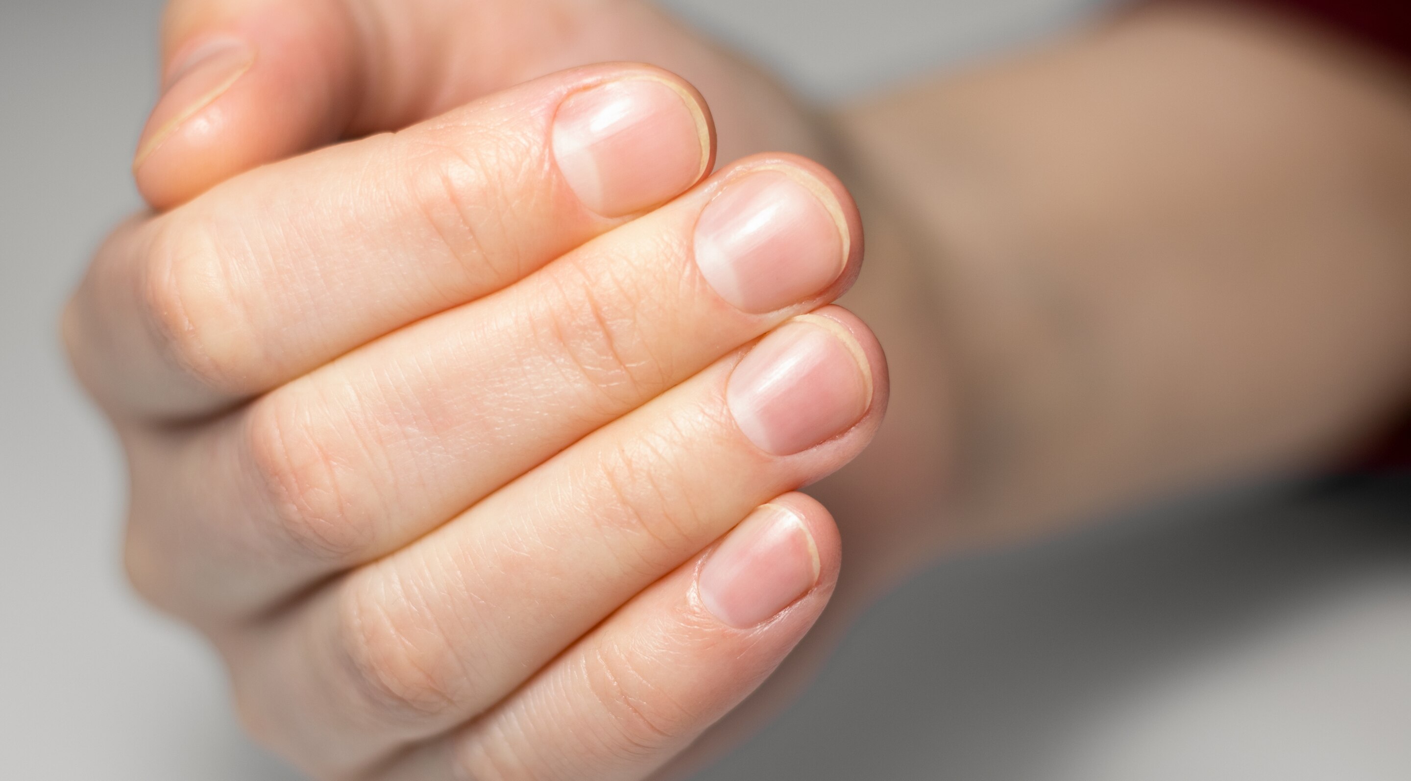 Step 1: Assess Your Natural Nail Health