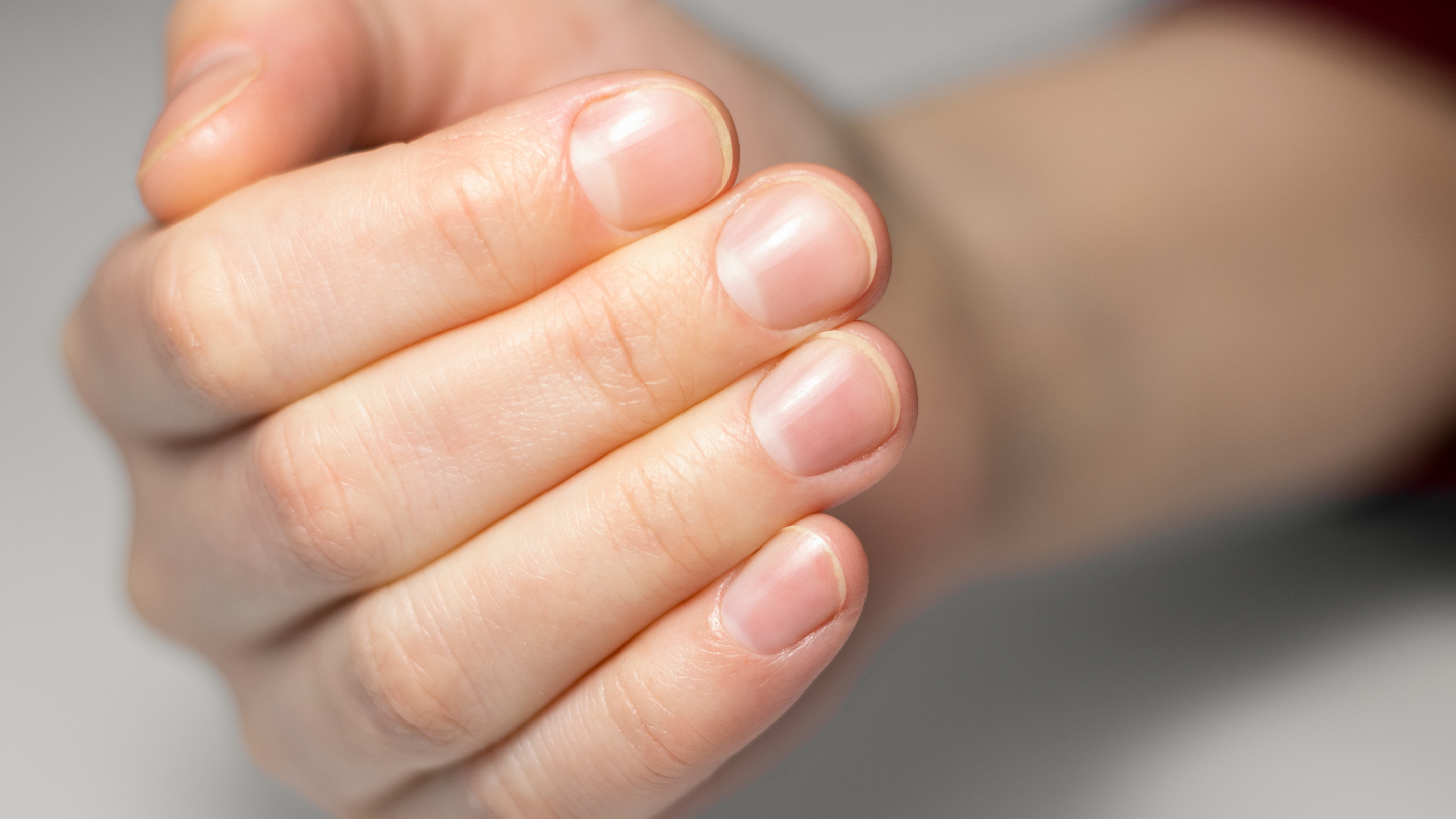 Step 1: Assess Your Natural Nail Health