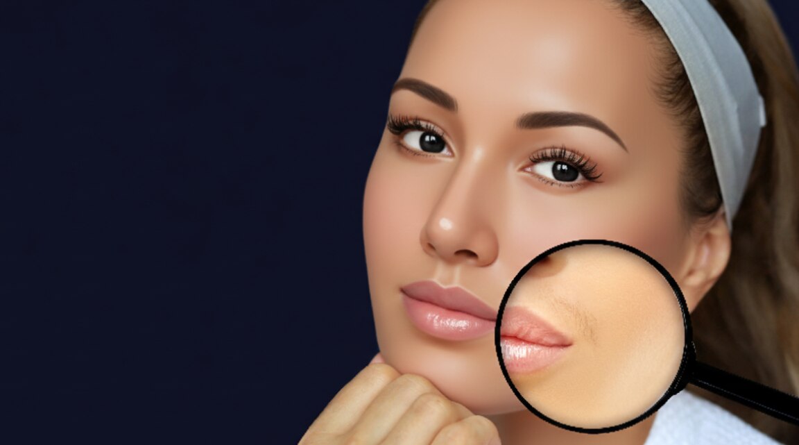 How to Remove Facial Hair at Home Naturally