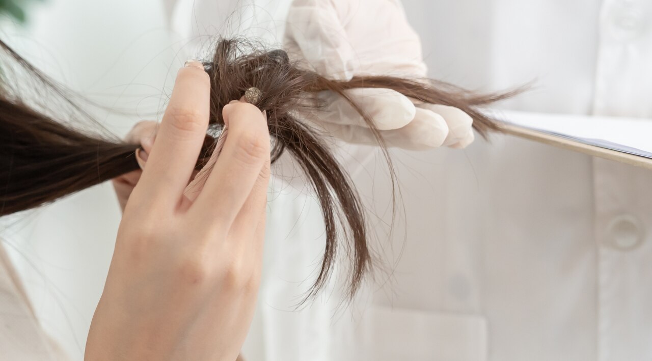 What Is Thinning Hair?
