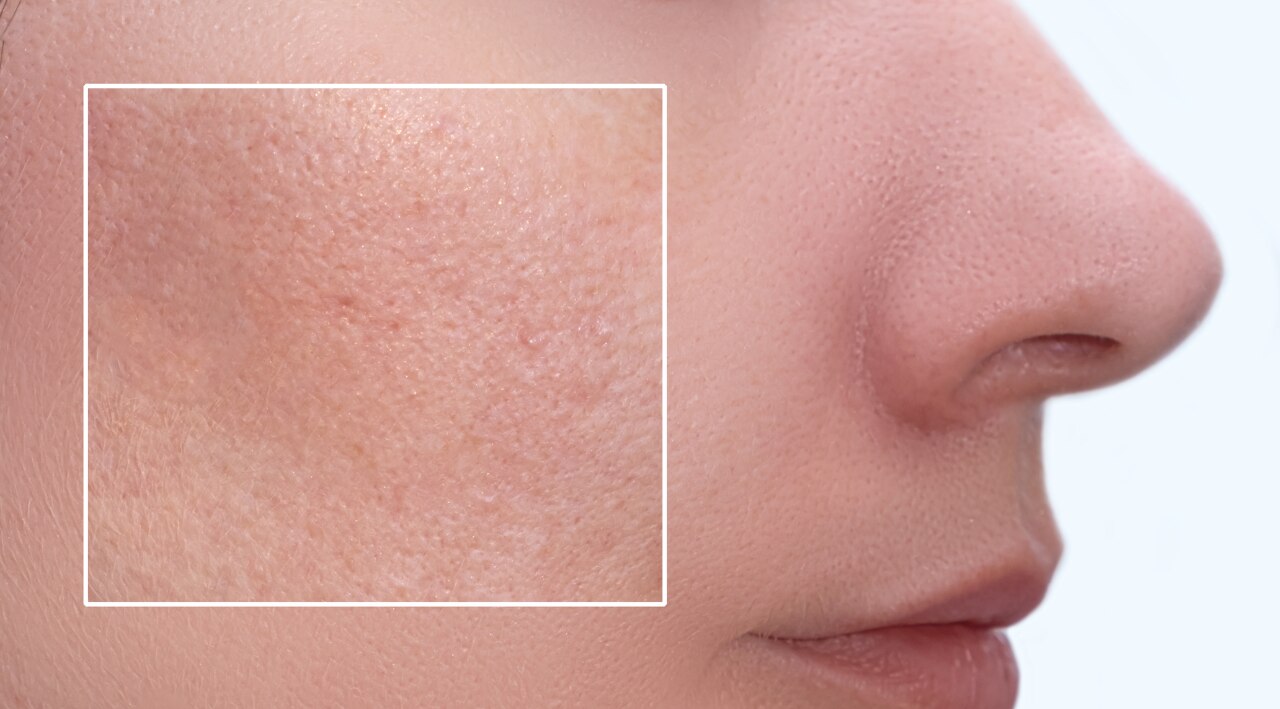 Common Causes of Bumps on Skin