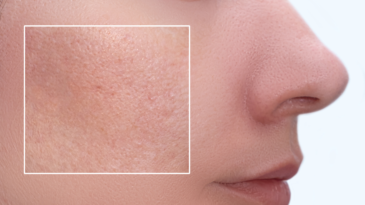 Common Causes of Bumps on Skin