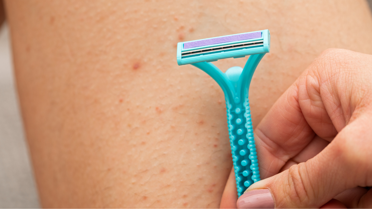 Folliculitis
