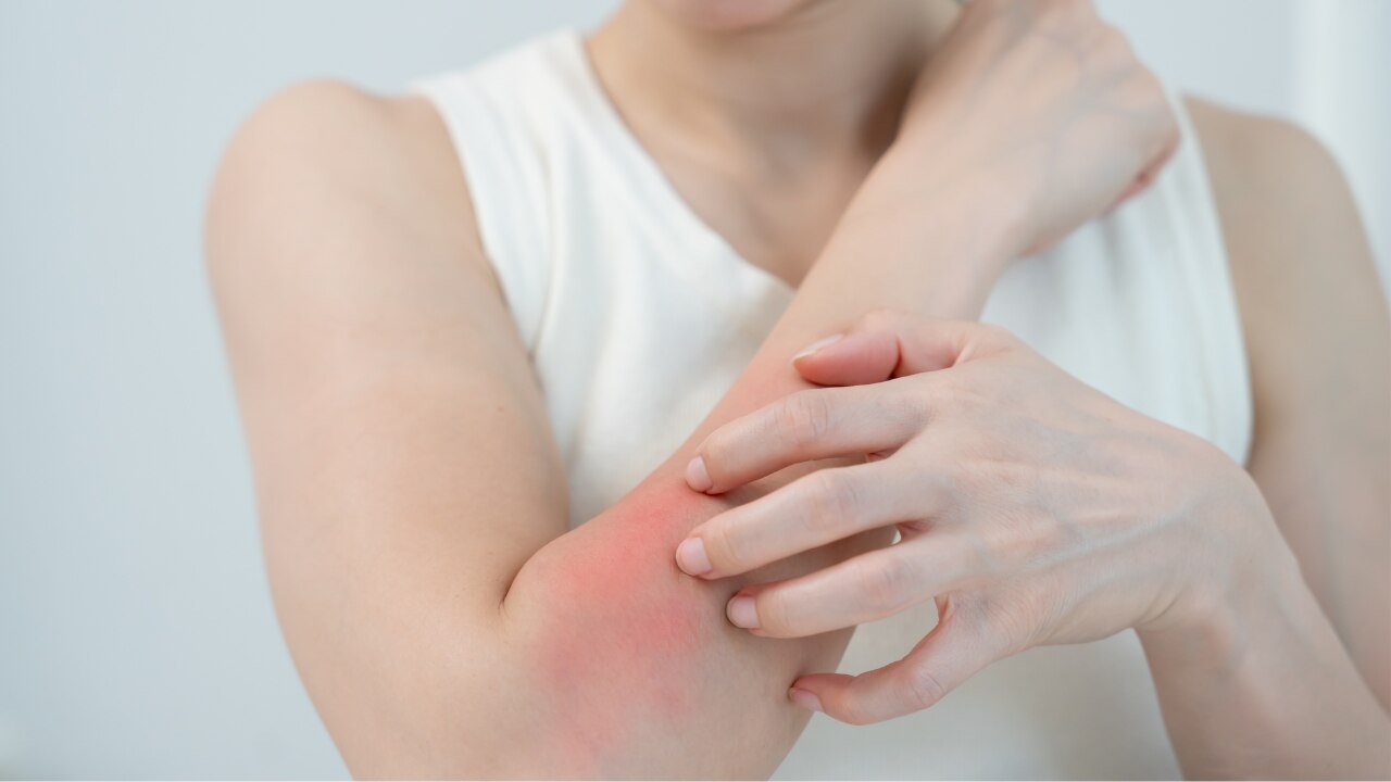 What Are Bumps on Skin?