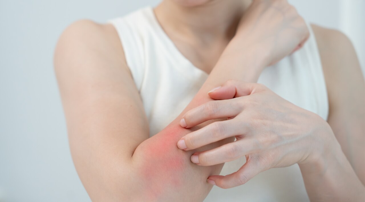 What Are Bumps on Skin?