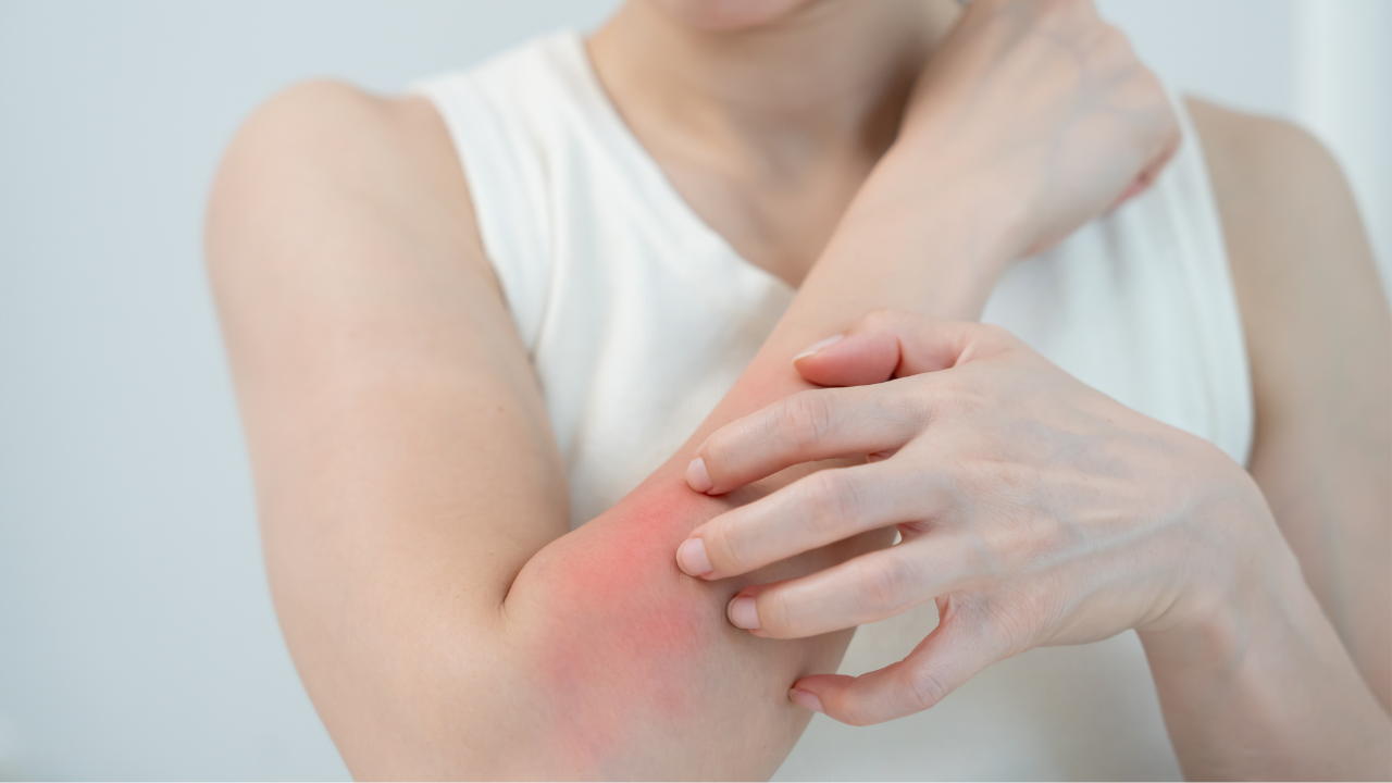 What Are Bumps on Skin?