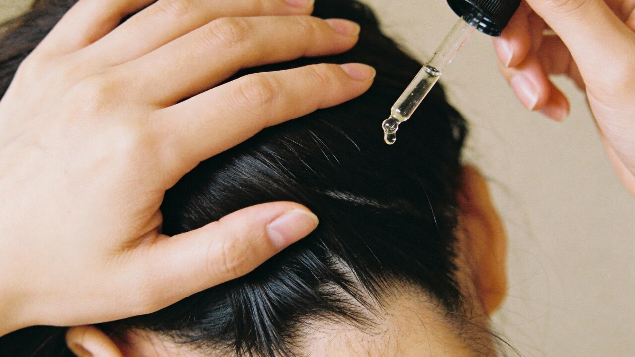 Home Remedies to Stop Dandruff and Hair Fall