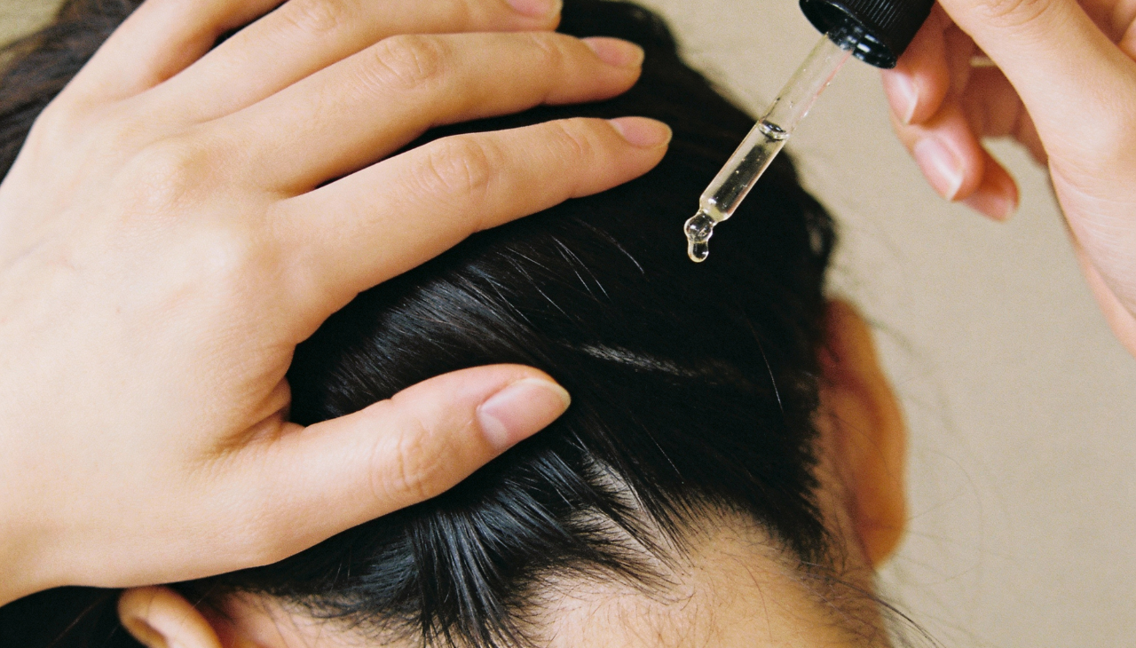 Home Remedies to Stop Dandruff and Hair Fall