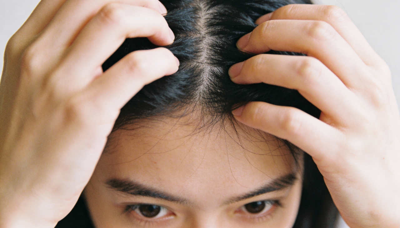 Kalonji Oil for Hair Side Effects
