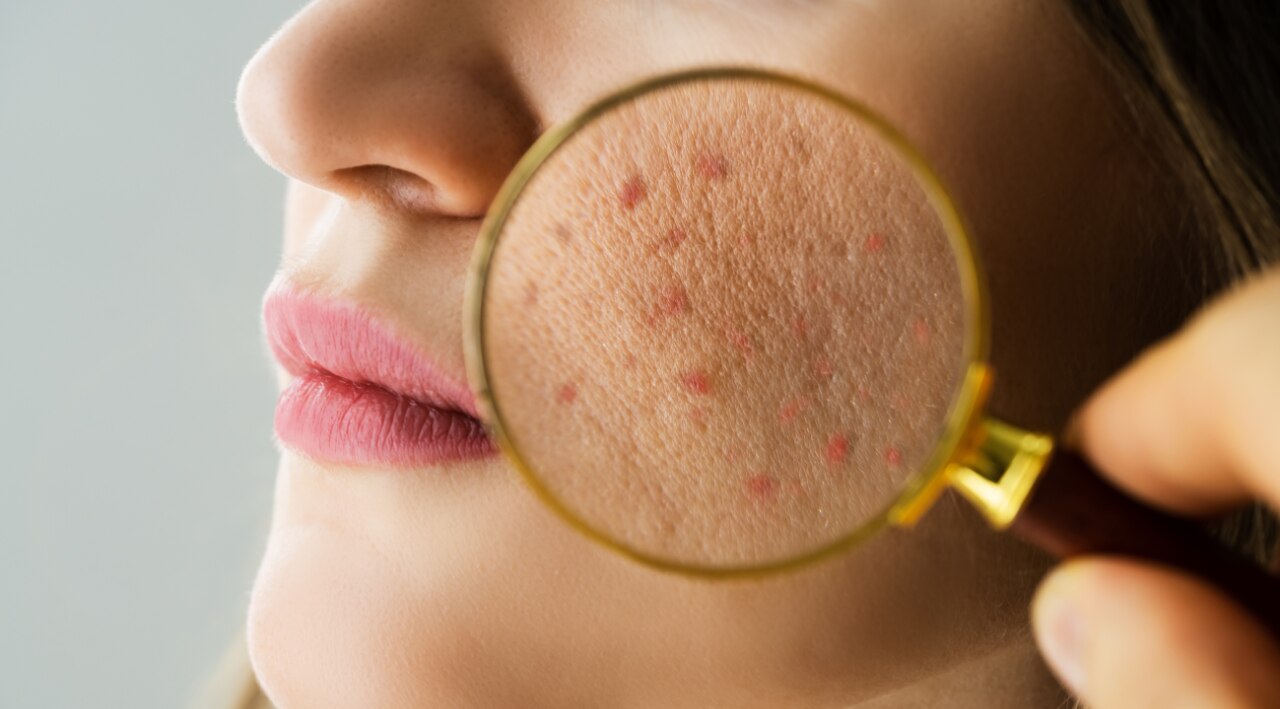 Why Is It Important to Remove Makeup Properly?
