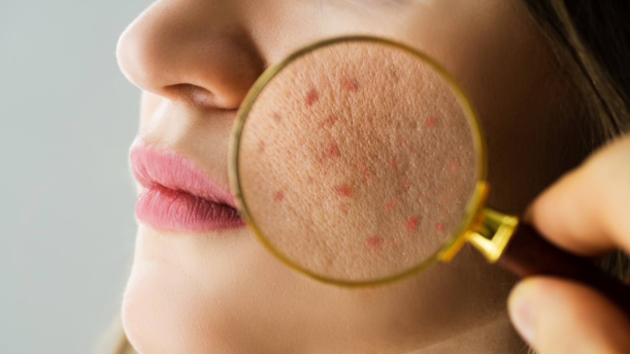 Why Is It Important to Remove Makeup Properly?