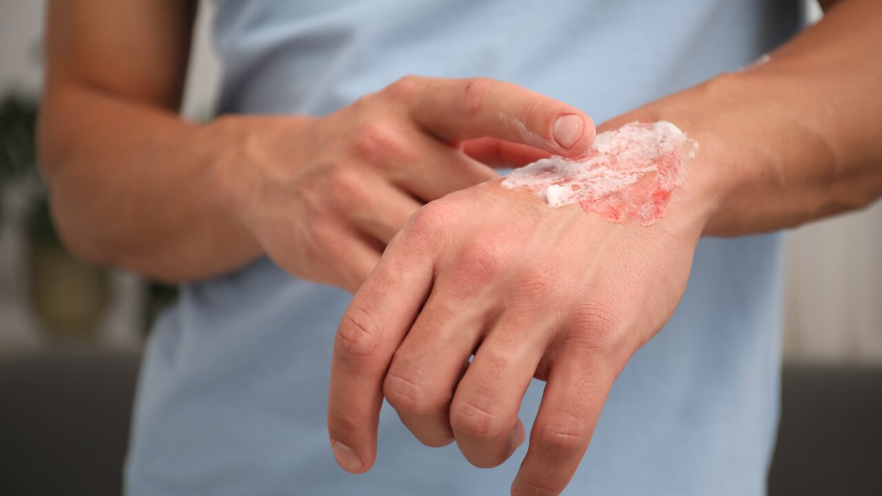Accelerates Healing: