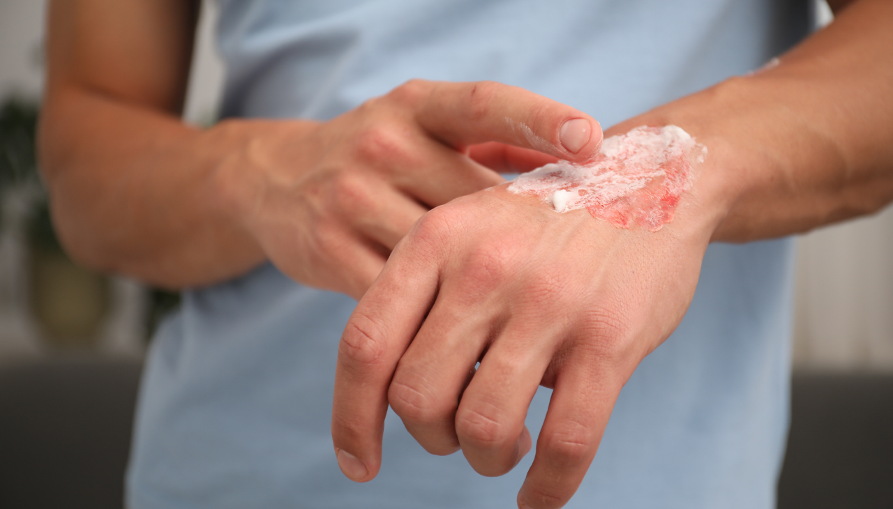 Accelerates Healing:
