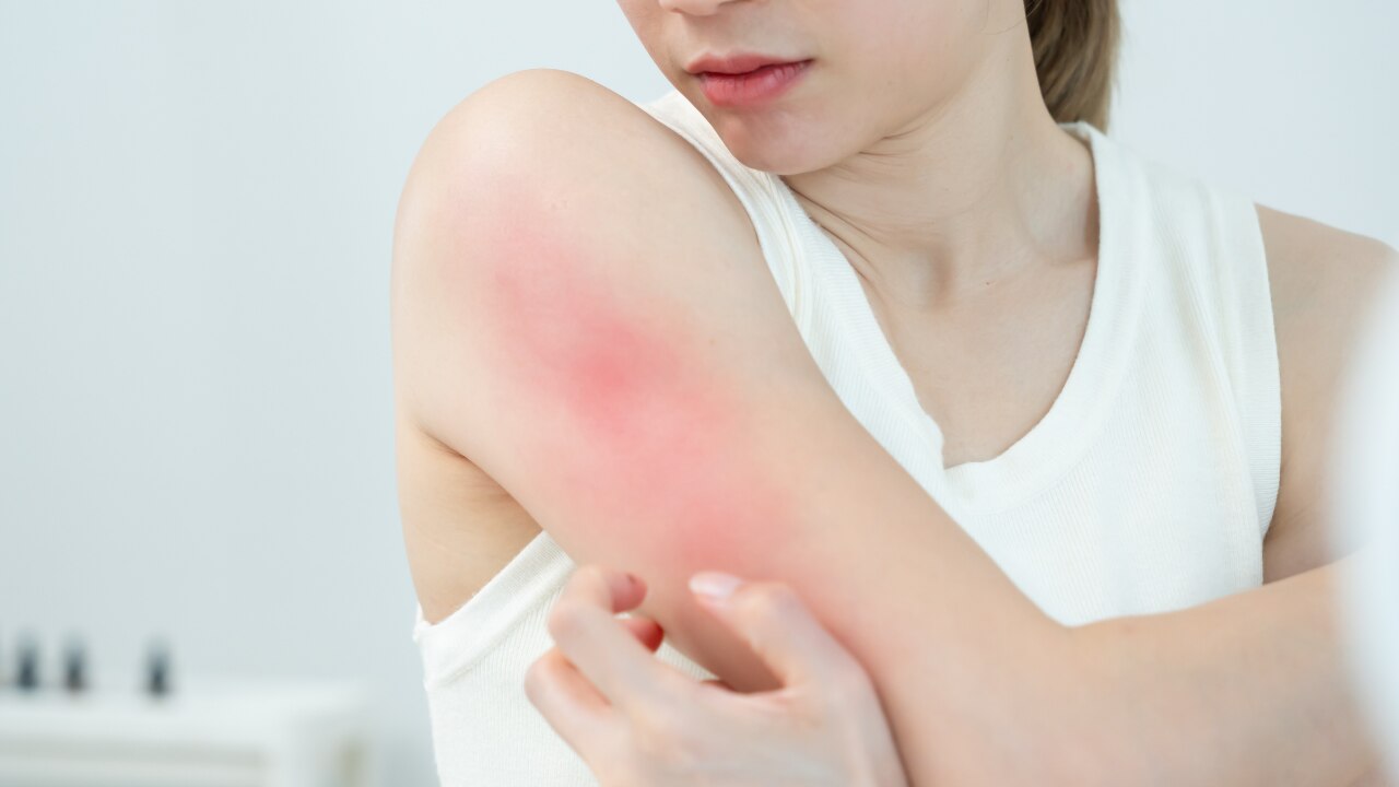 Soothes Inflammation: