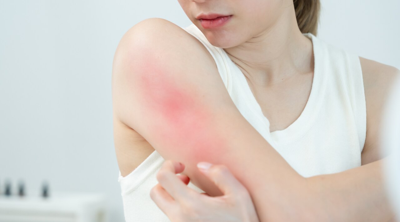 Soothes Inflammation: