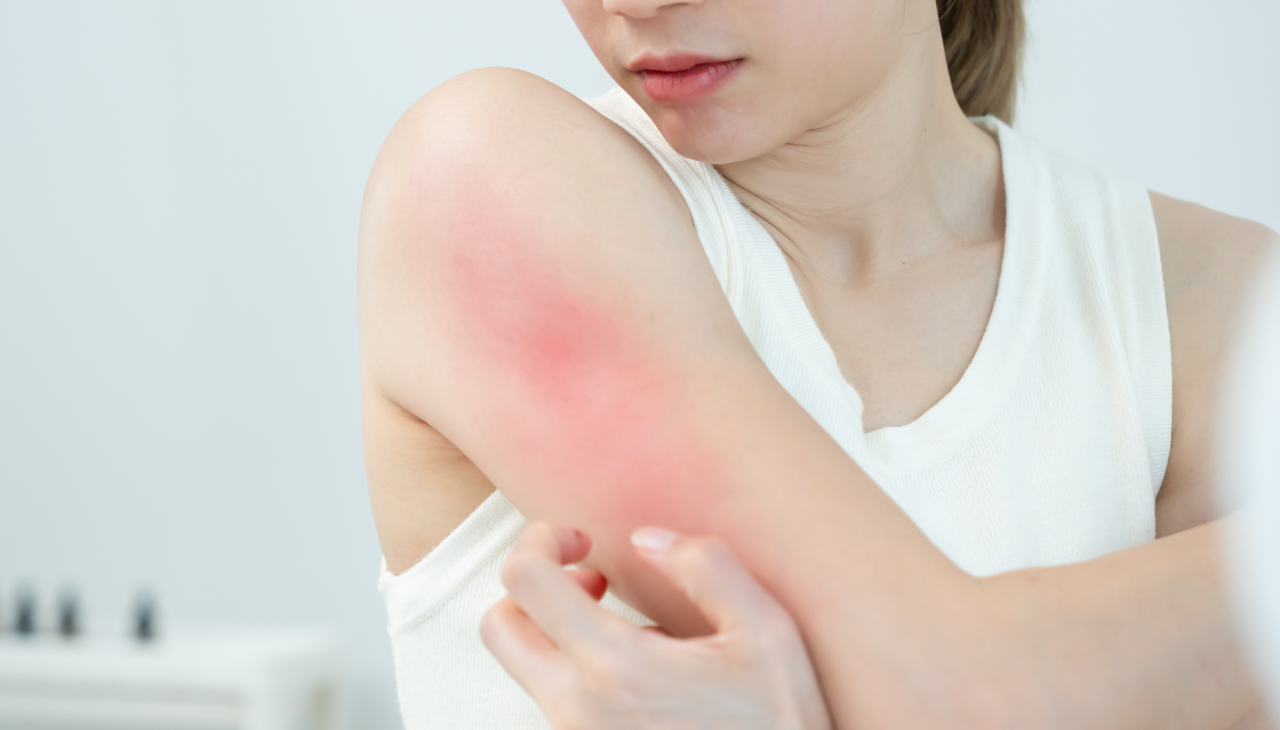 Soothes Inflammation: