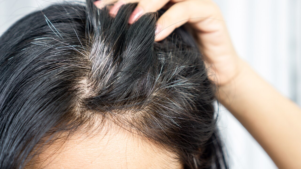 6. Prevents Premature Graying