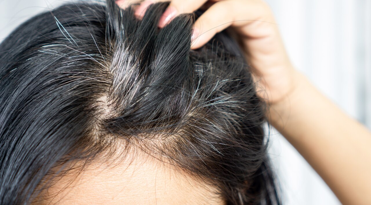 2. Prevents Premature Greying: