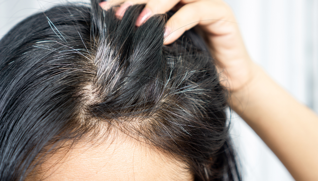 2. Prevents Premature Greying: