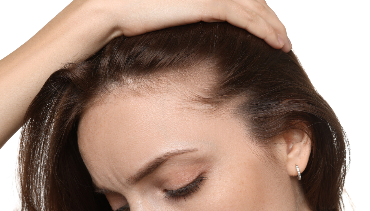 6. Reduces Hair Thinning: