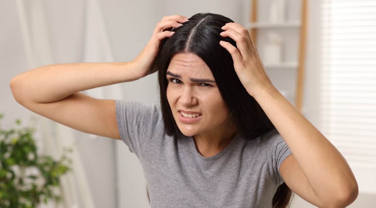 Is Aloe Vera Good for Dandruff?
