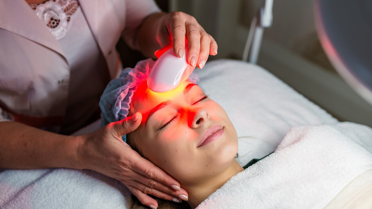 Intense Pulsed Light (IPL):