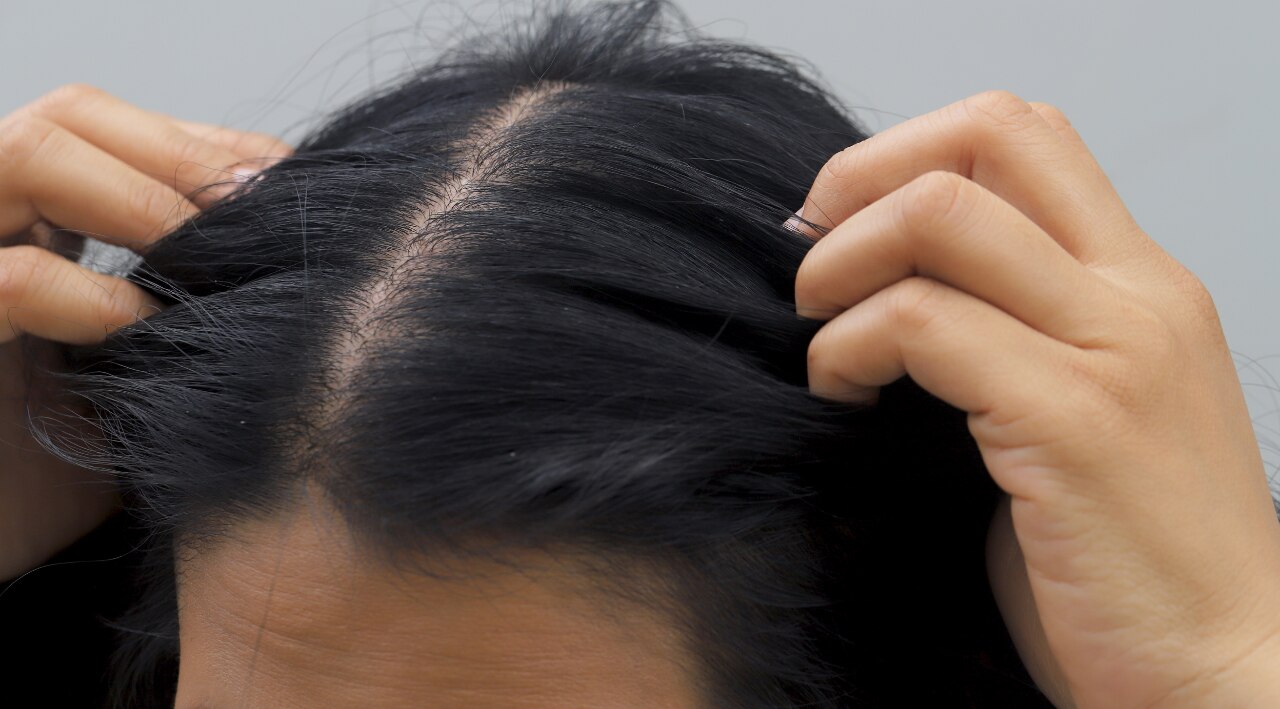 Side Effects of Tea Tree Oil