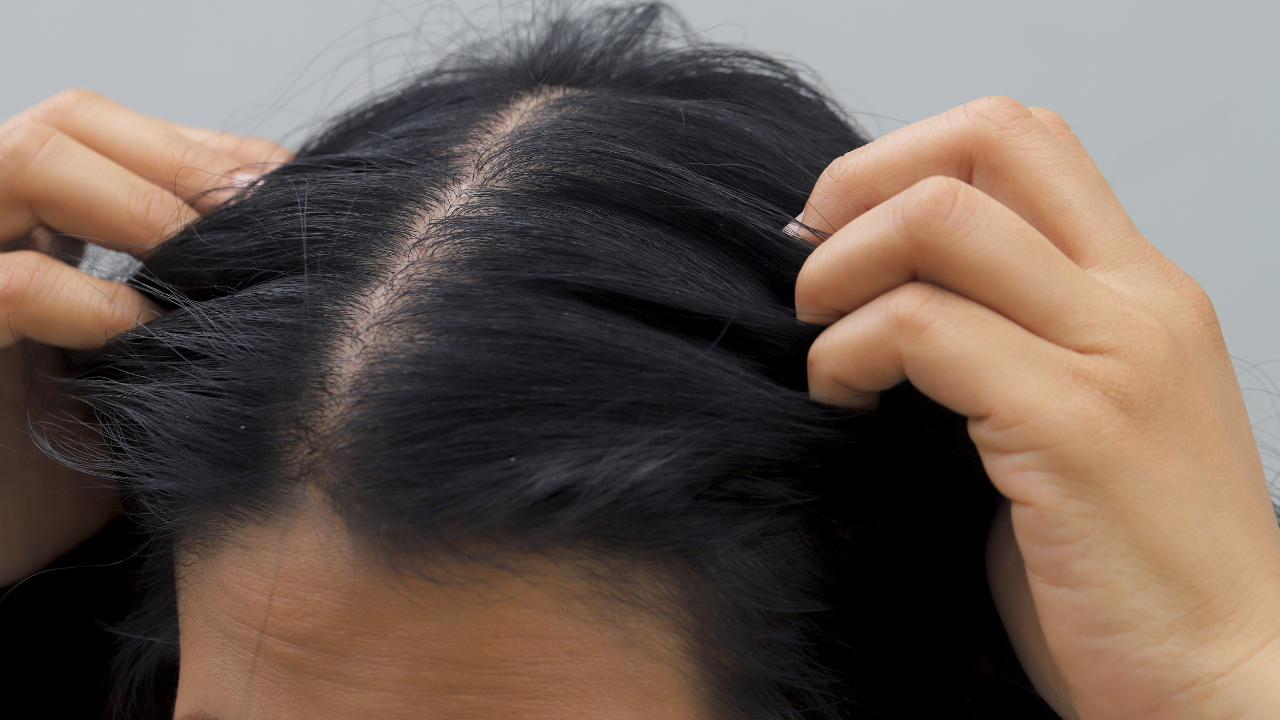 Side Effects of Tea Tree Oil