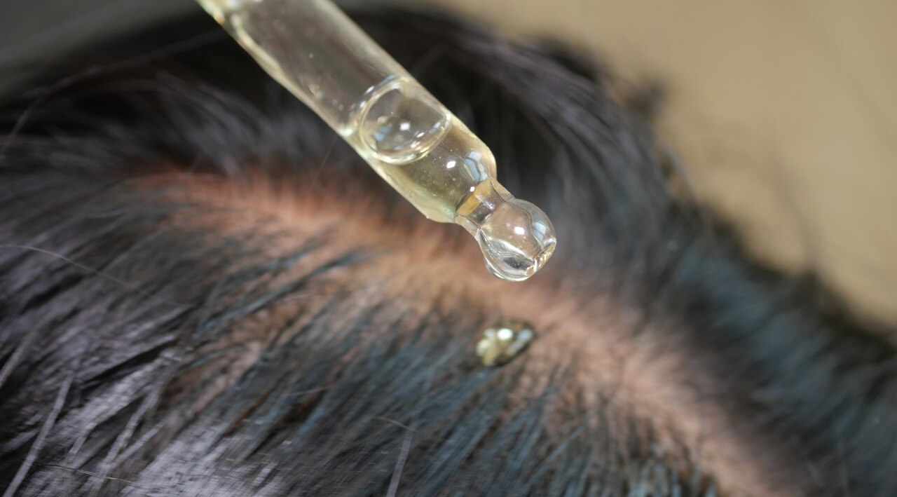 Benefits of Onion Juice for Hair Growth