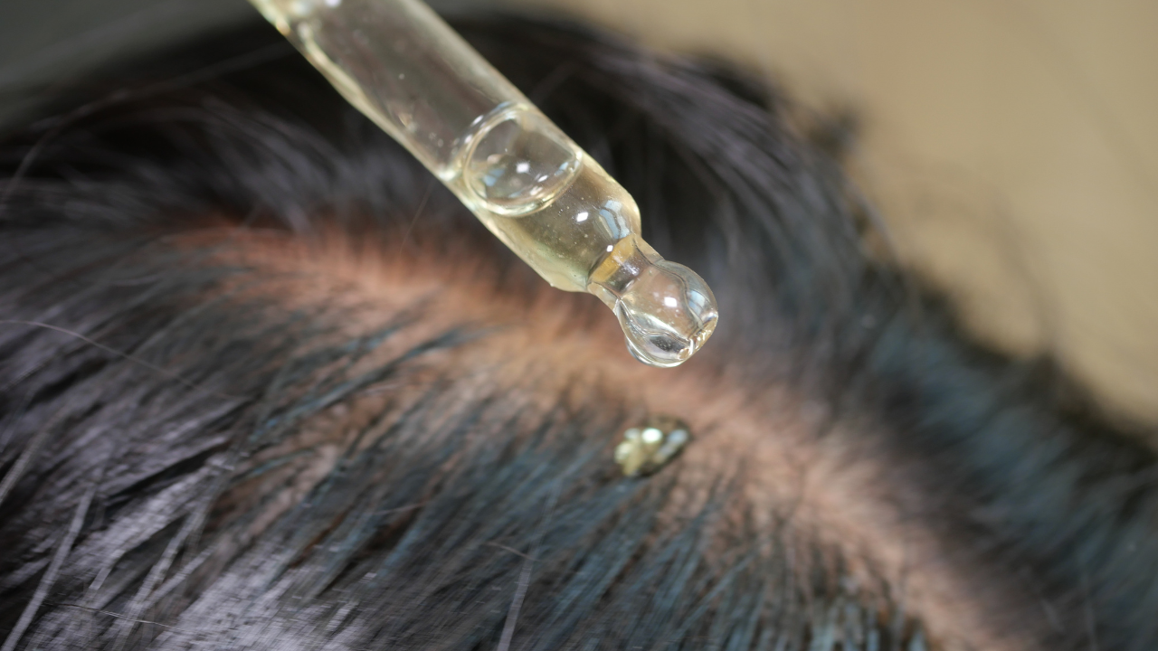 Benefits of Onion Juice for Hair Growth