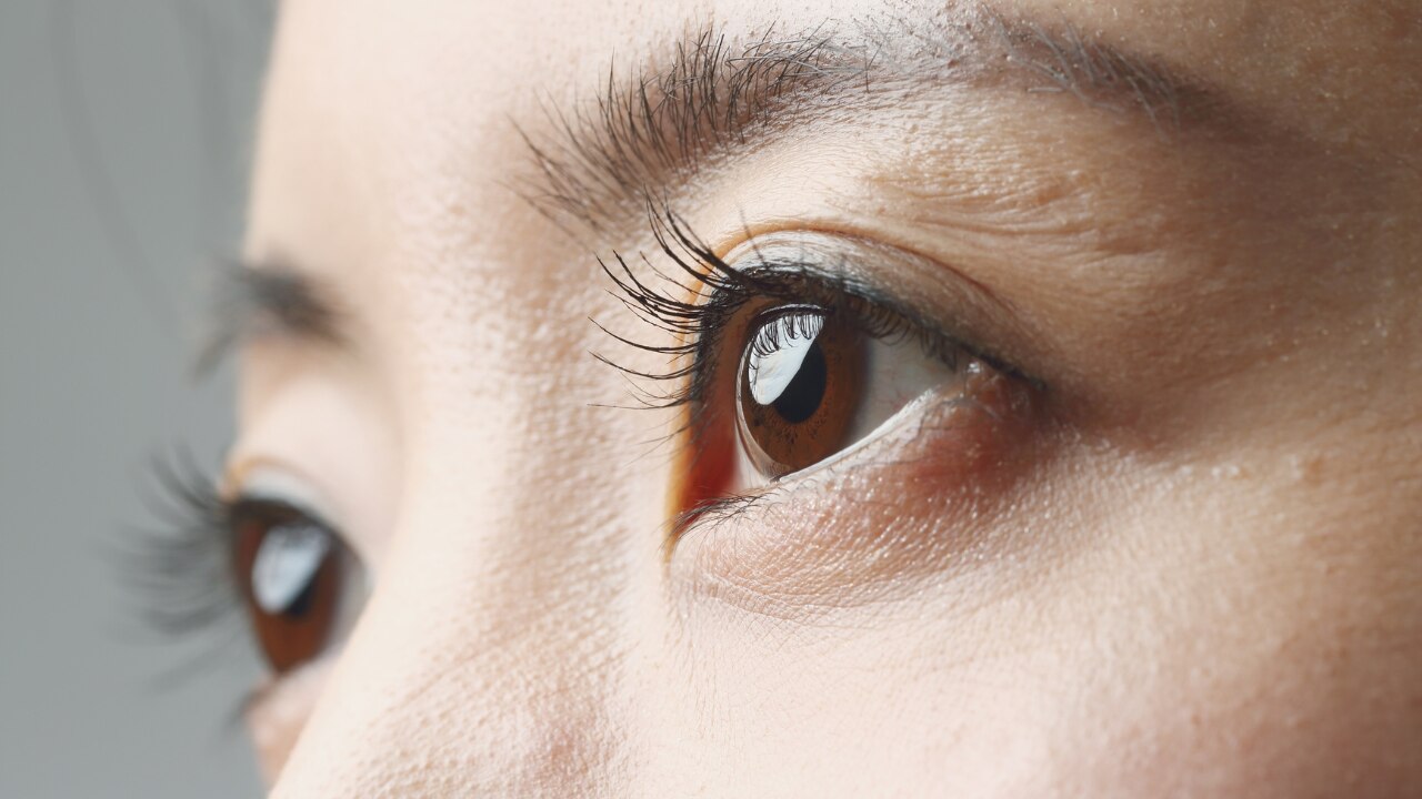 Why Eyelashes Become Thin and Weak