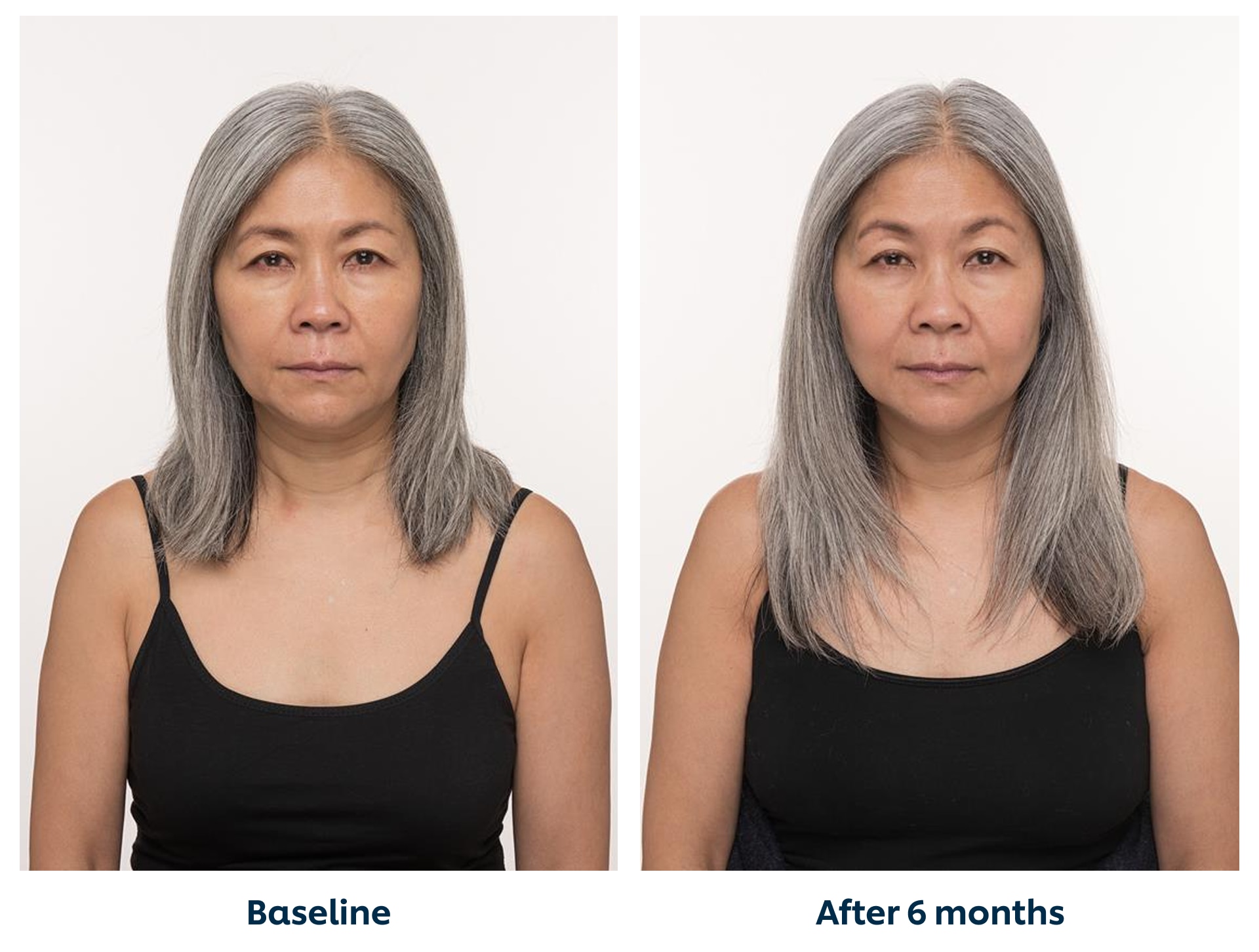 Blinded Investigator Global Hair Assessments