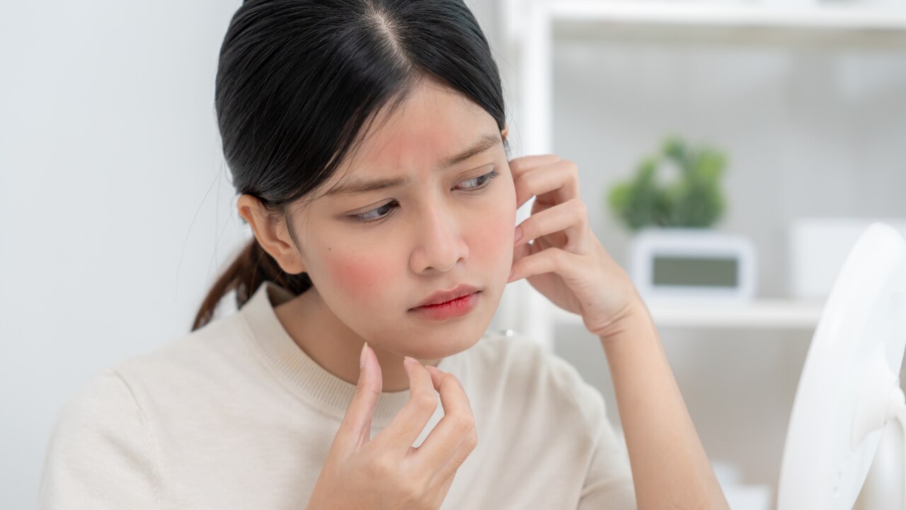 Allergic Contact Dermatitis: