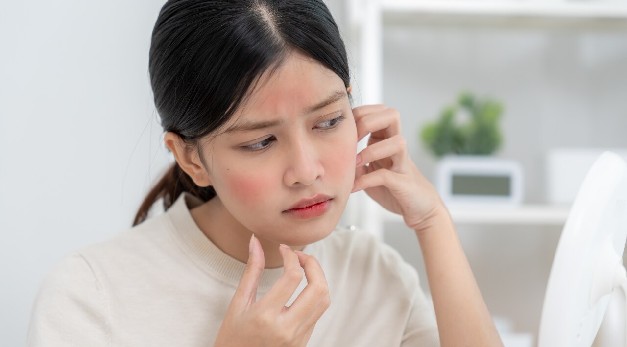 Allergic Contact Dermatitis: